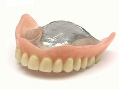 金属義歯