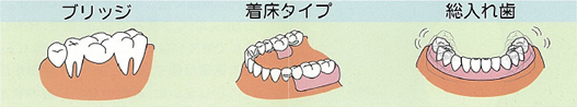 従来の治療法との比較